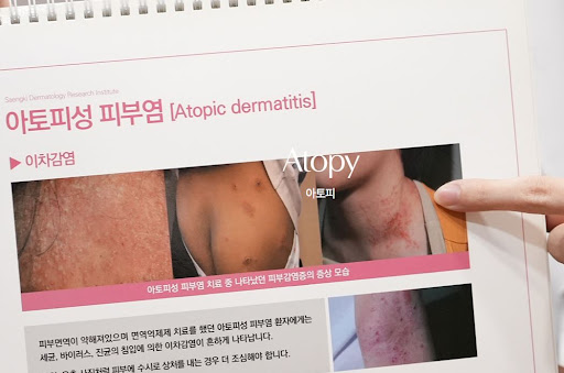 생기한의원으로 보는 아토피 2차 감염 의심 시 확인 내용