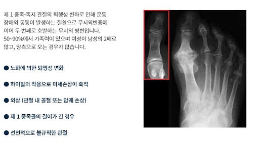 신림정형외과 / 바른사랑병원
